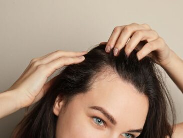 dark haired woman with hands on scalp