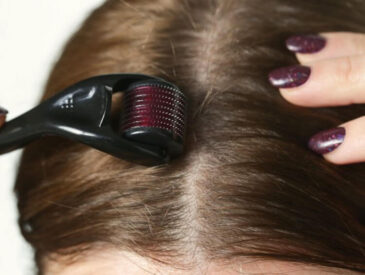 derma roller tool being applied to the scalp